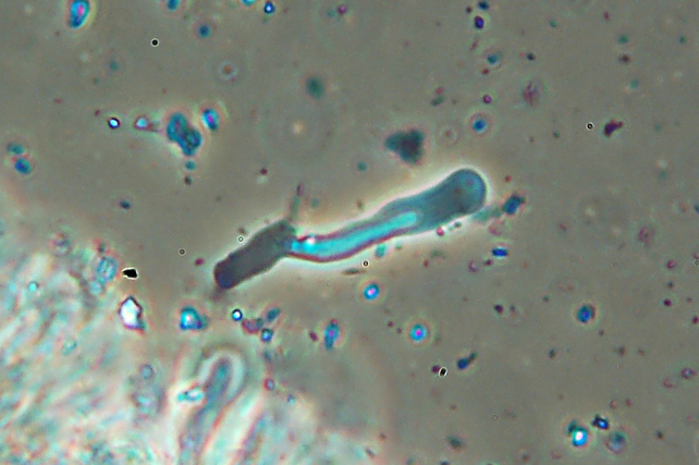Crosticina affiorante - foto 3379 (Byssomerulius corium?)